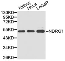 NDRG1 Antibody