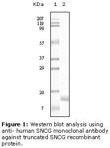 SNCG / Gamma-Synuclein Antibody (clone 1H10D2)