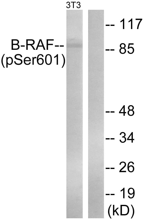 Polyclonal Rabbit anti-Human BRAF / B-Raf Antibody (phospho-Ser602, IHC, WB)