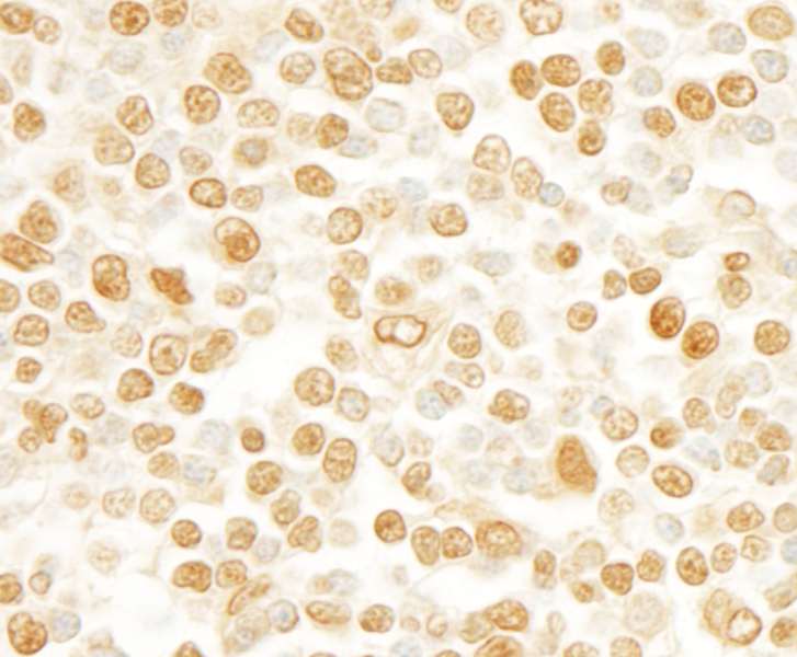 SCAF11 / SFRS2IP Antibody (aa1098-C-term)
