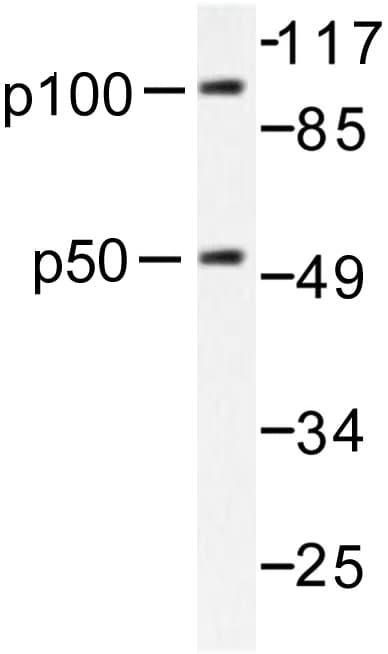 NFKB1 / NF-Kappa-B Antibody (Val887)