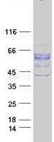 Human ALK3 / BMPR1A Protein (Recombinant Myc-DDK (Flag))