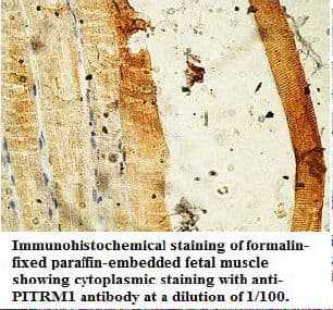 PITRM1 / MP1 Antibody (aa679-925)