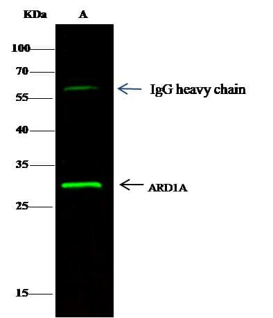 NAA10 / ARD1A Antibody (clone 10, Preservative Free)