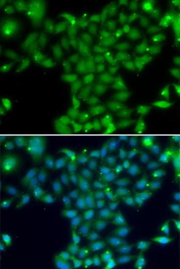 TGM5 / Transglutaminase 5 Antibody