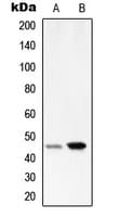SERPINA1 / Alpha 1 Antitrypsin Antibody (Internal)