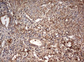 PARN Antibody (aa1-266, clone OTI4D12)