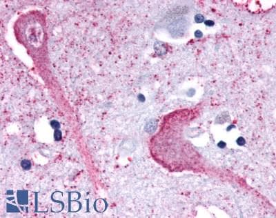 PathPlus™ KISS1R / GPR54 Antibody (N-Terminus)