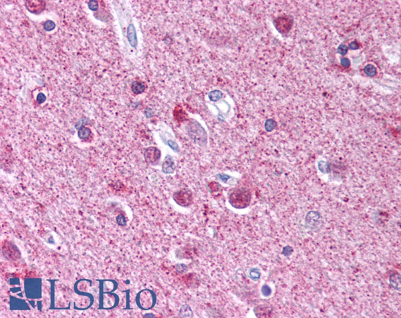 IHC-plus™ Polyclonal Rabbit anti-Human ATG9A Antibody (aa750-839, IHC, WB)