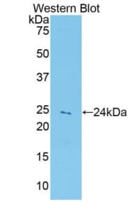 PRDX5 / Peroxiredoxin 5 Antibody (aa1-210, PE)