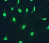 IHC-plus™ CUL1 / Cullin 1 Antibody (Internal, clone EPR3102Y)