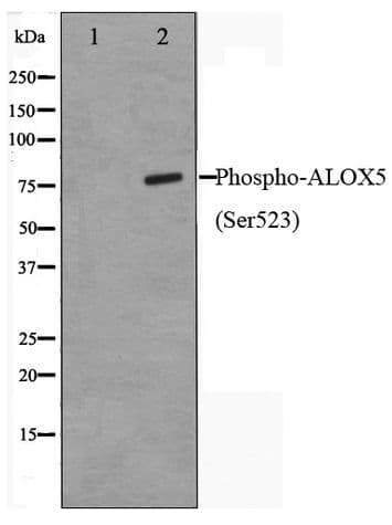 ALOX5 / 5-LOX Antibody (phospho-Ser523)