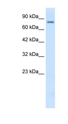 KCNN3 / SK3 Antibody (aa642-691)