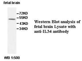 IL34 Antibody (aa21-242)