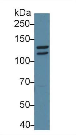 STAT2 Antibody (aa658-912)
