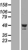 PLA2G15 / ACS Protein (Over-Expression Lysate Myc-DDK (Flag))