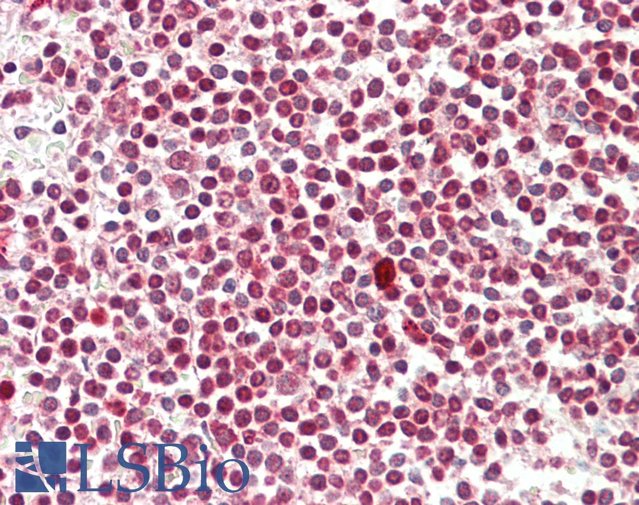 IHC-plus™ DAPK1 / DAP Kinase Antibody (aa274-323)