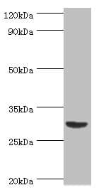 BAFF / TNFSF13B Antibody (aa76-285)