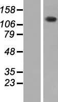 PHKA2 Protein (Over-Expression Lysate Myc-DDK (Flag))