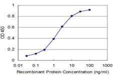 IHC-plus™ ARHGEF11 Antibody (clone 2H7)