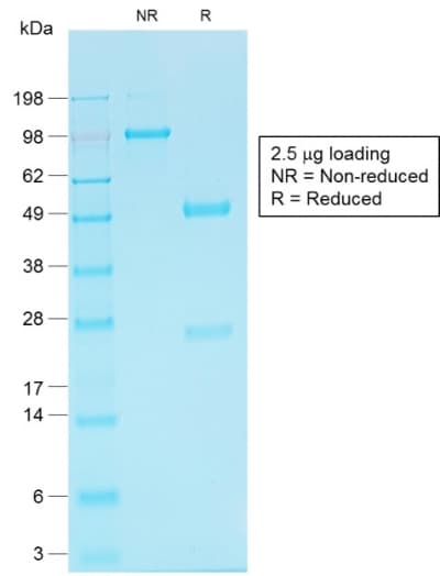 IHC-plus™ CDH16 / Cadherin 16 Antibody (clone CDH16/1532R)