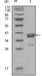 ABL1 / c-ABL Antibody (clone 7B11D6)