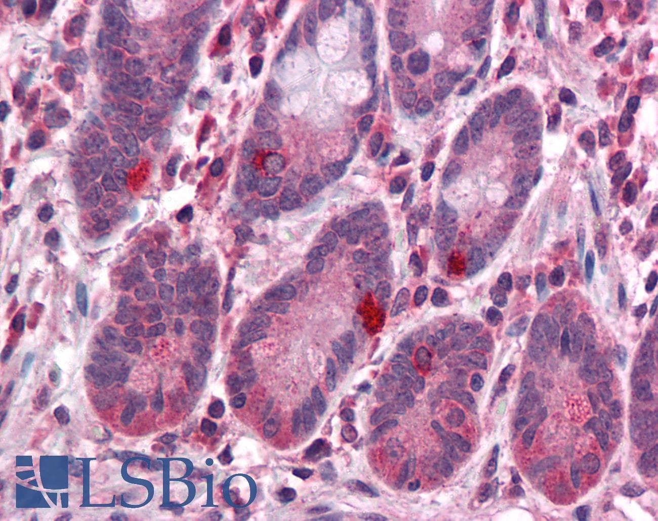 IHC-plus™ GALNT10 Antibody