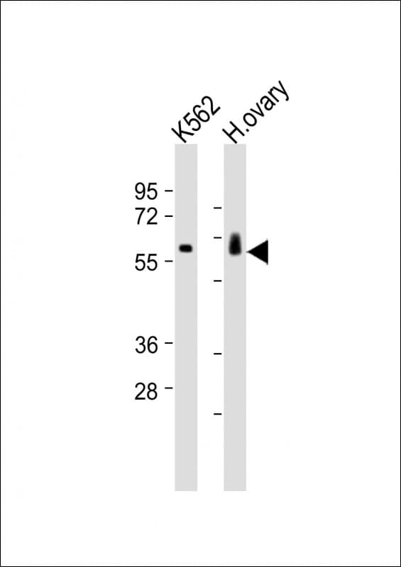 Polyclonal Rabbit anti-Human C17orf80 Antibody (aa264-696, WB)