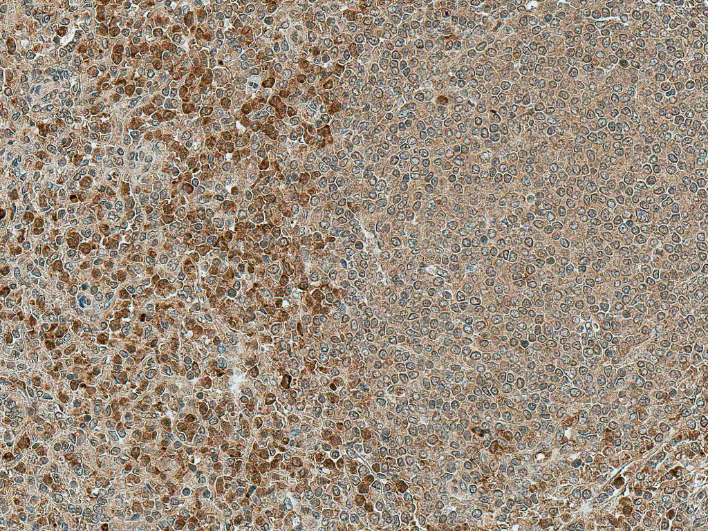 NFATC1 / NFAT2 Antibody