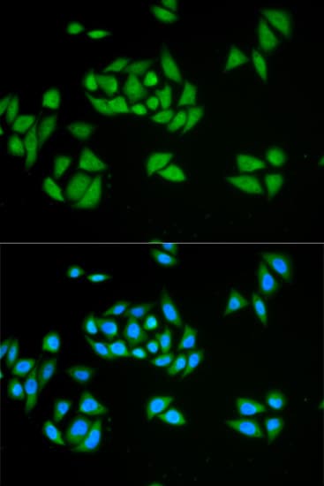 RENT1 / UPF1 Antibody