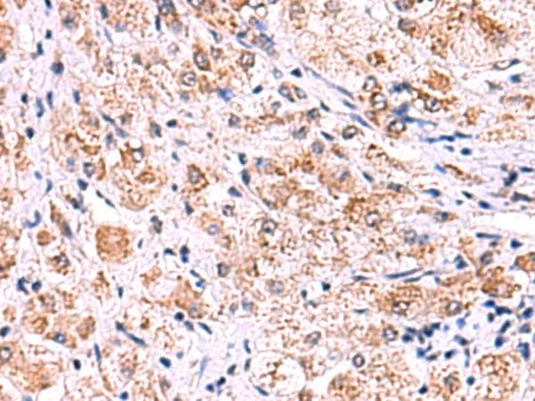 Polyclonal Rabbit anti-Human ECSIT Antibody (IHC)