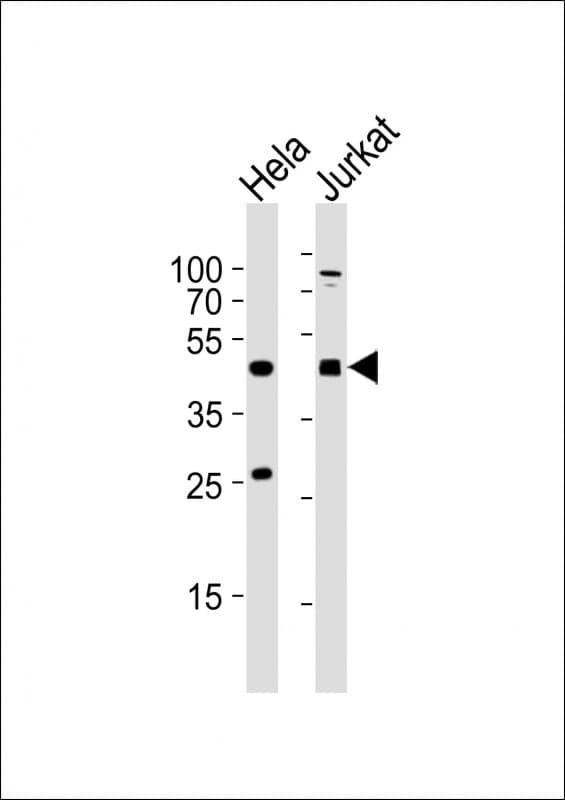 AVPR2 / V2R Antibody (aa343-377)