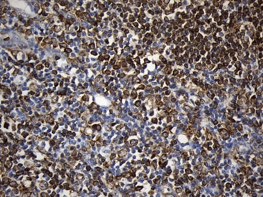 CD74 / CLIP Antibody (clone UMAB232, Carrier-free)