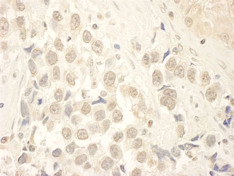 MYST2 / HBO1 Antibody (aa125-175)