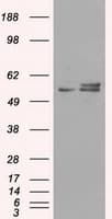 ATP5B / ATP Synthase Beta Antibody (clone OTI4E5)