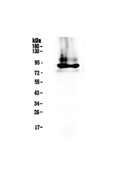 F2 / Prothrombin / Thrombin Antibody