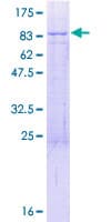 Human NOP9 Protein (Recombinant GST)