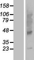 SLC35G5 / AMAC1L2 Protein (Over-Expression Lysate Myc-DDK (Flag))