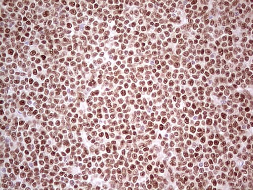 Monoclonal Mouse anti-Human NR3C1/Glucocorticoid Receptor Antibody (clone OTI3F1, aa1-265, IHC, WB)
