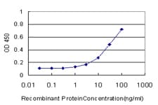 UROS Antibody (clone 1E11-B11)