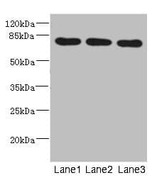 BBS2 / BBS Antibody