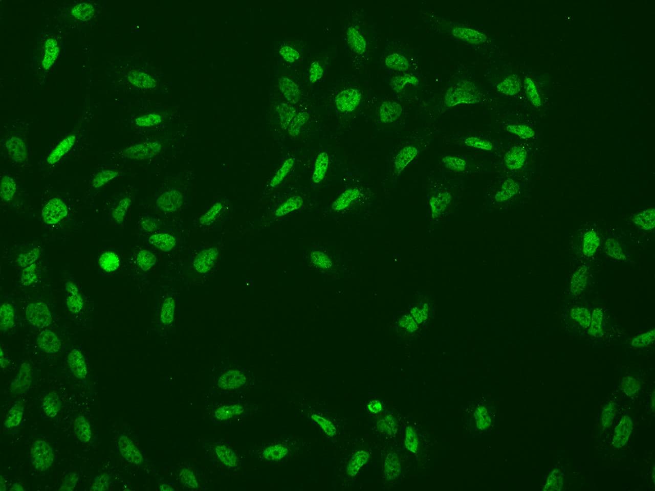 RAD17 Antibody