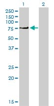 PRKCI / PKC Iota Antibody (clone 1G11)