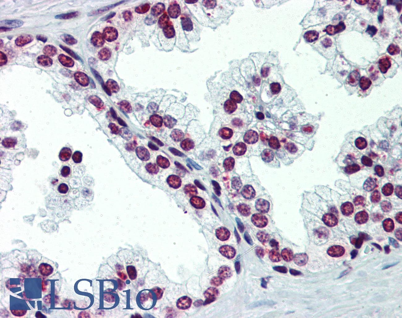 Polyclonal Rabbit anti-Human ARID5A Antibody (C-Terminus, IHC, WB)