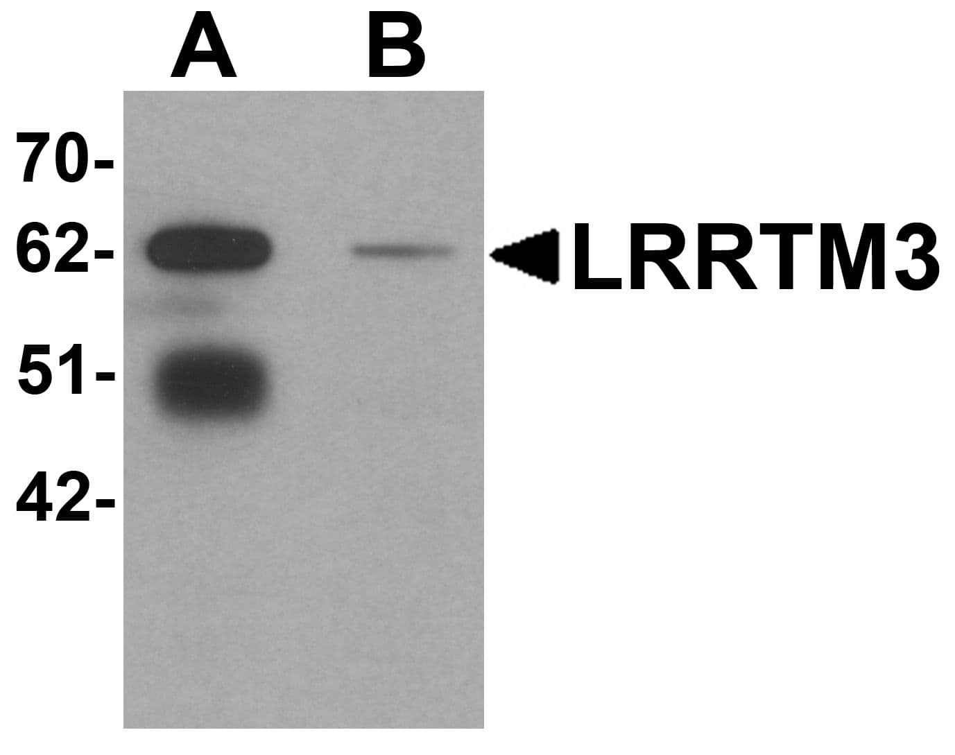 IHC-plus™ LRRTM3 Antibody
