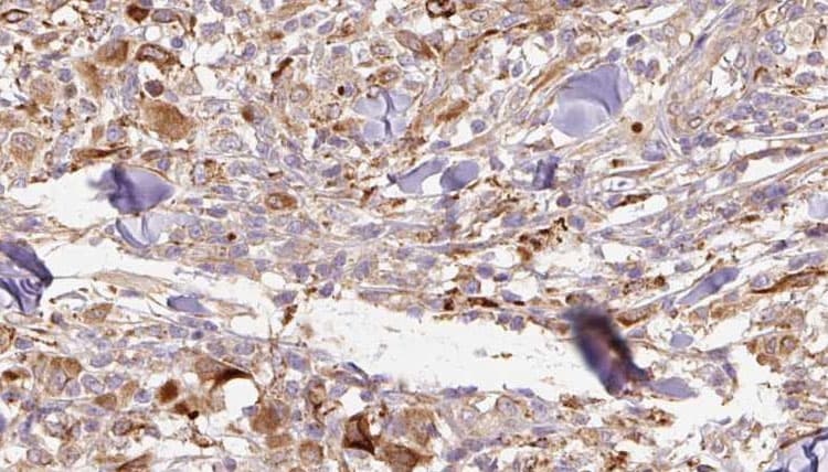 Polyclonal Rabbit anti-Human IL1RN Antibody (IHC, WB)