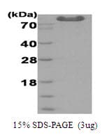 Arthrobacter globiformis DMGO Protein (Recombinant His)