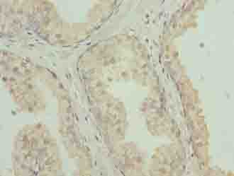 CLEC3A Antibody