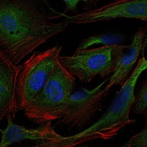 Monoclonal Mouse anti-Human CRK Antibody (clone 3G11E8, IHC, IF, WB)