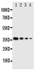 Polyclonal Rabbit anti-Human LAT2 / NTAL Antibody (aa34-48, WB)